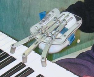 Chord playing prosthesis